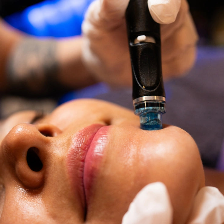 Hydrafacial Signature